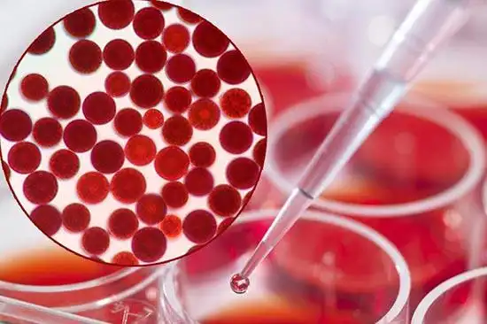 哪些是抗氧化的物质?