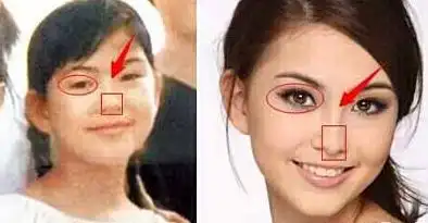 昆凌整容前后照片对比 昆凌14岁旧照出土对比差很大