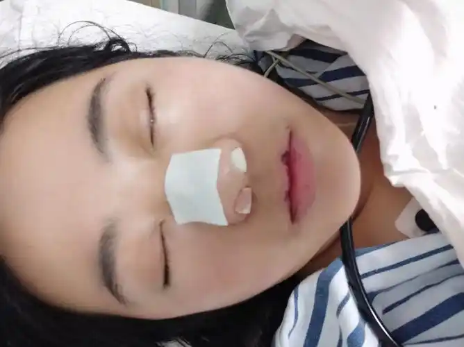 鼻窦炎手术的感觉如何,手术前和手术后你有哪些想分享的? - 知乎