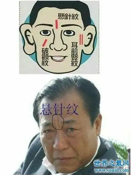 【图】悬针纹真的是因为长时间不开心所导致的 该怎么