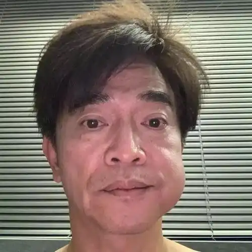 吴宗宪的半边脸明显肿了一大包.