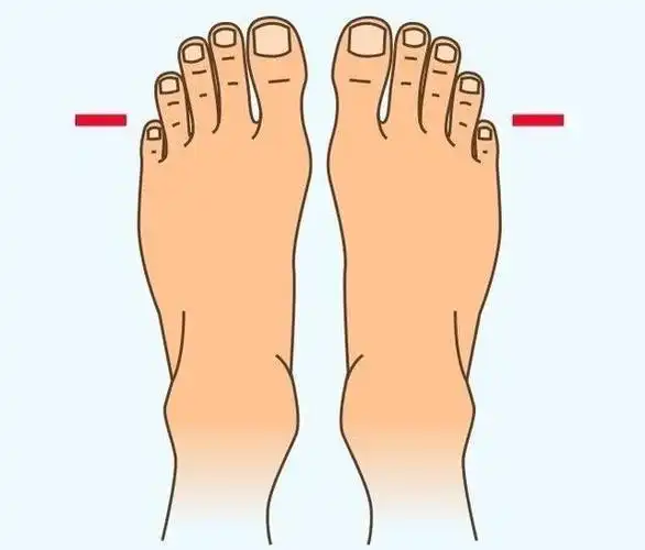 忍痛穿一双好看的鞋去逛街没必要买鞋前先看看你是什么脚型