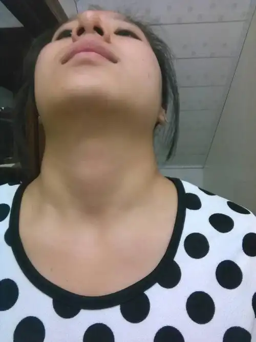 一仰头脖子两侧有点鼓起来的是什么地方_百度知道