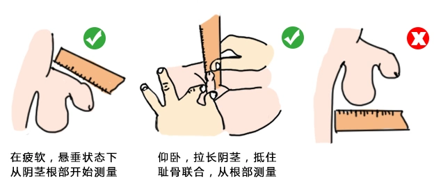 测量从耻骨联合阴茎根部至顶端的距离(不包括包皮长度)