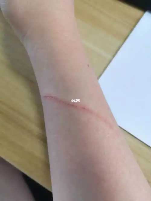 才剪指甲为啥能抓这么长00