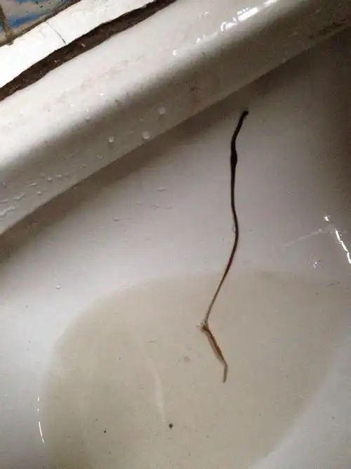 成人大便拉出来的虫子,请问有没有谁或者专家知道这是什么类型的寄生