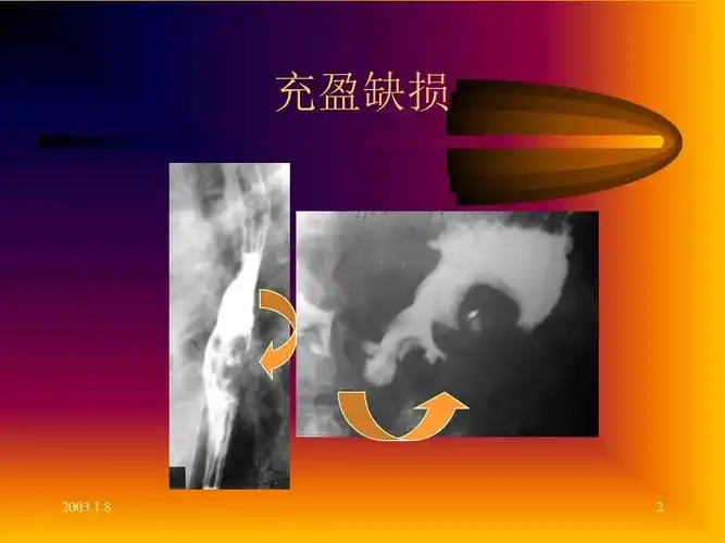 医学影像学第七版_胃肠道ppt