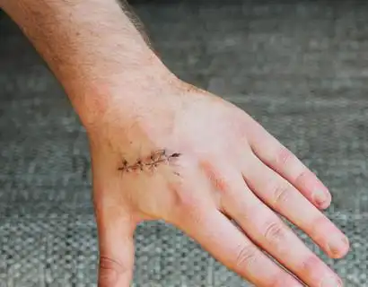 事故概念的痛苦