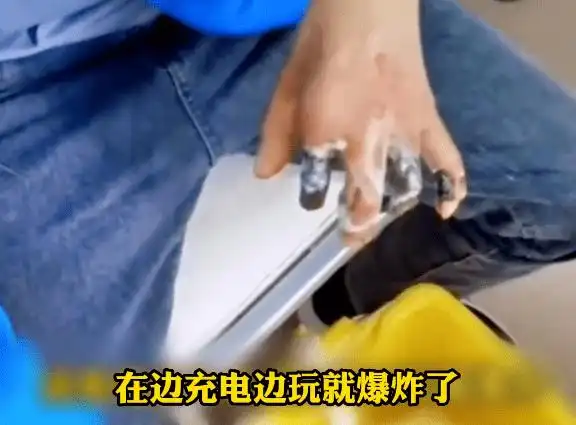 被炸得焦黑一只手中有两根手指头结果手机爆炸贵州一男子边充电边玩