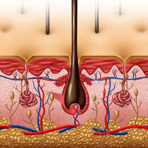the hair follicle can be amputated through injury