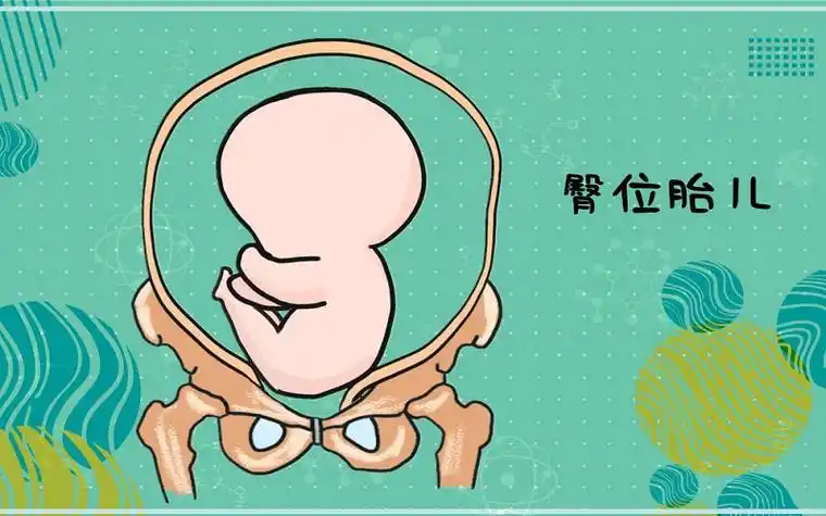 老话说臀位生的女孩娘娘命迷信or科学一文告诉你