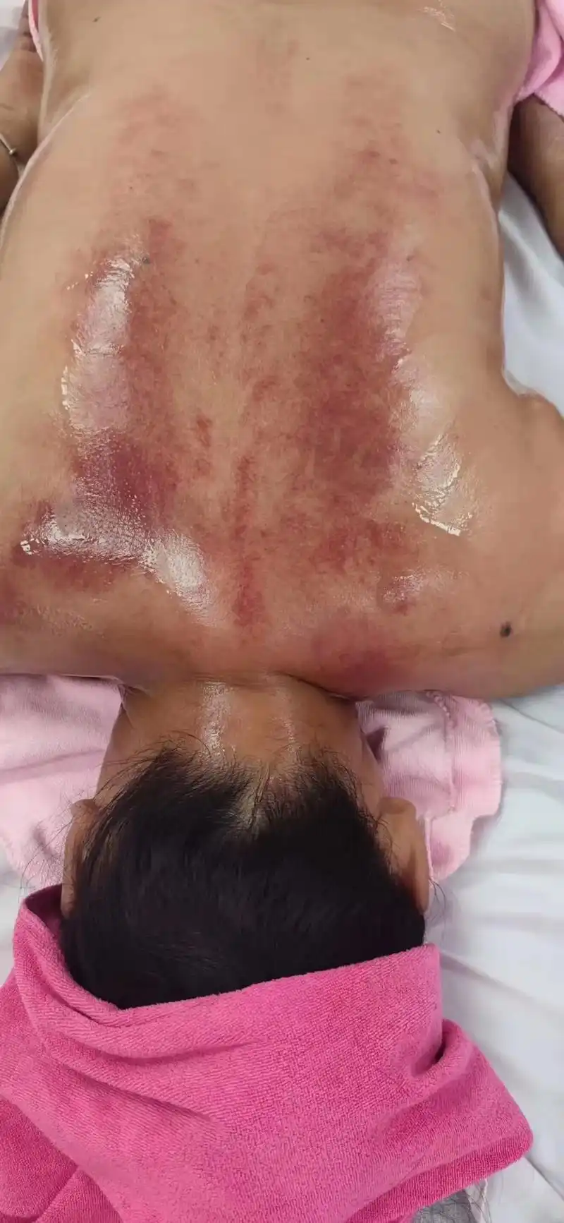 [爱心]【精油开背小知识】有些人做完背感觉又累又痛,这是用精 - 抖音