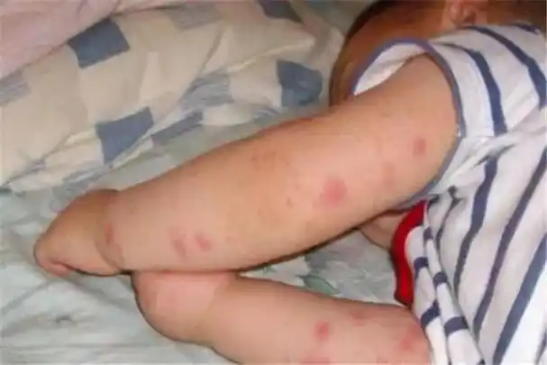 九成人不知"蟑螂"的天敌是啥:屋里放1个它,蟑螂会"自觉消失"了