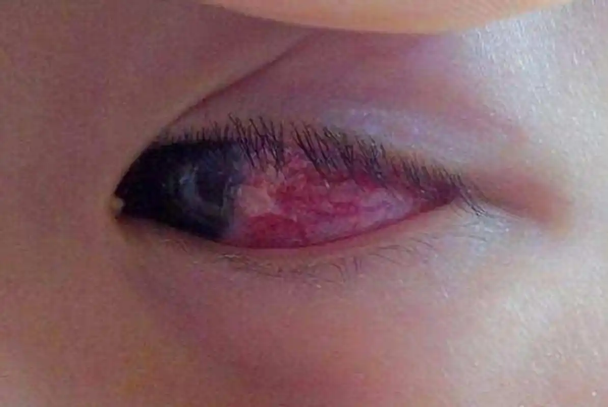 特别是一些发光的玩具,对宝宝的眼睛会有特别大的影响,轻者导致视力