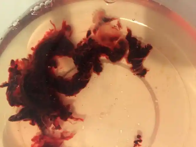 药流最后一次吃药后当时胎囊就流出来了,现在已经一星期了,血量一直不