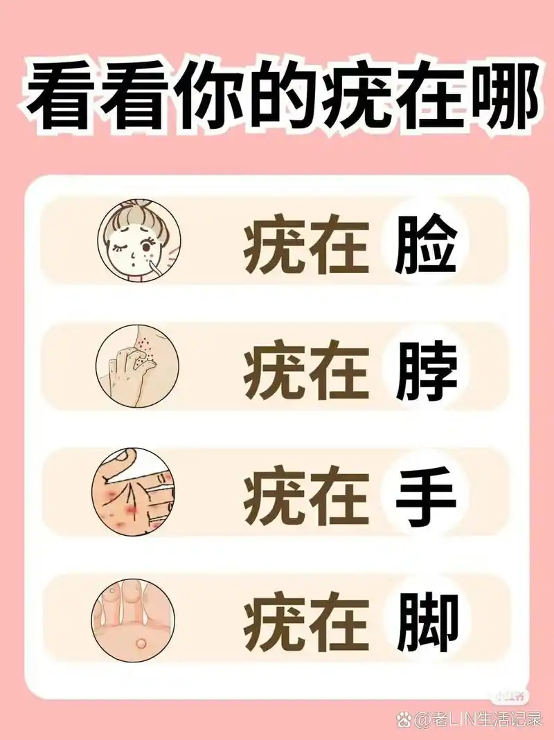 快来看看你的疣在哪里?