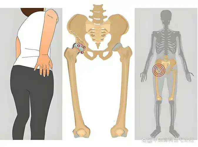 髋关节在哪里,如何进行灵活性训练