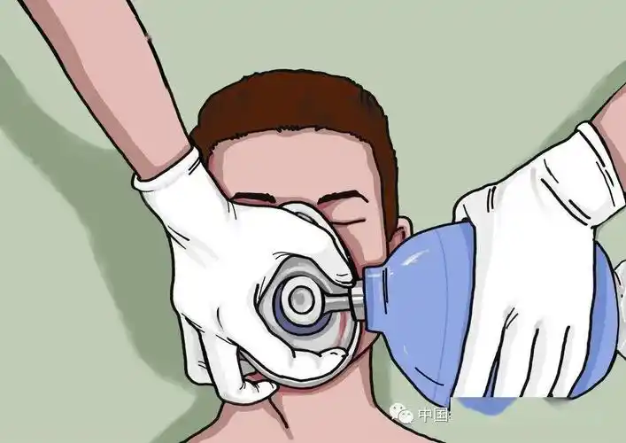 100-120次/分钟,直到取得人工通气设备(单向阀人工呼吸面罩)后可进行