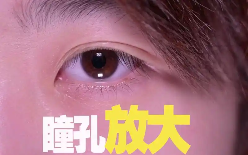 mydriasis 瞳孔放大