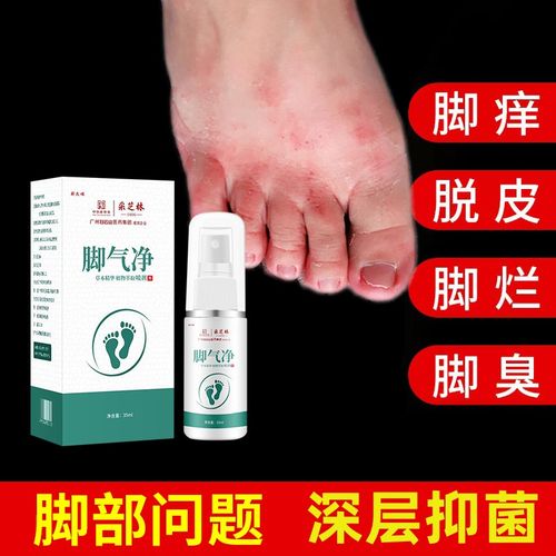 脚痒除脚起皮脱皮臭脚包抑菌除臭喷雾水脚臭出汗发痒止痒祛臭