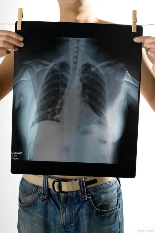 聊聊骨科门诊中拍片子的那些事儿