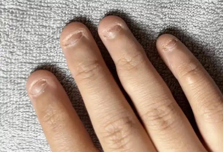 恐怕对于"爱啃指甲"的孩子来说,坏习惯的危害可不止手指头的不美观这