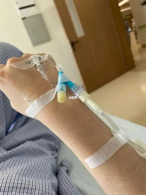 术前打针,埋套管,因为禁食水,打的盐水和糖水