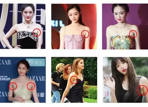 关于副乳的疑惑,看完这篇文章就够了!