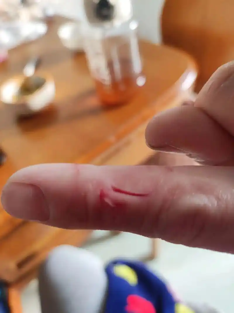 掐指一算是血光之灾没跑了,最近不开心吧,来喽,给你个烂指头开 - 抖音