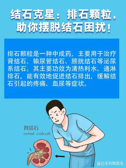 保守排石治疗的动画排石颗粒对肾有害吗肾结石排掉出来过程示意图片