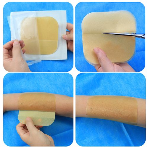 187955保护贴伤口人工褥疮压疮敷料康维德胶体水胶伤口敷料