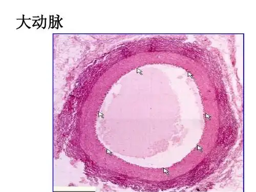 解剖实验 大动脉