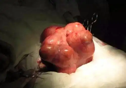 可去医院检查完,全家人却被吓出了冷汗.