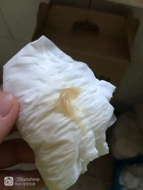 亲们,这是宫颈黏液吗?现在40 2天,还没有发动!有图慎入!