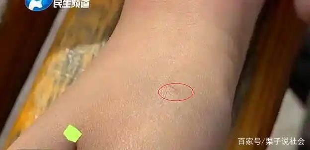 小区惊现上百不明针头,多名孩子被扎出血,孩子:没给家长说