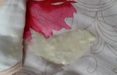 吐奶瓣,吐豆腐渣奶正常吗?