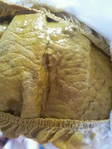 宝妈们帮我看看,6个月的宝宝便便里有黑色类似虫子的东西