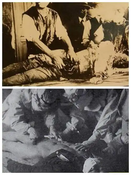 日本灭绝人性的恐怖活体解剖试验绝密731文件曝光