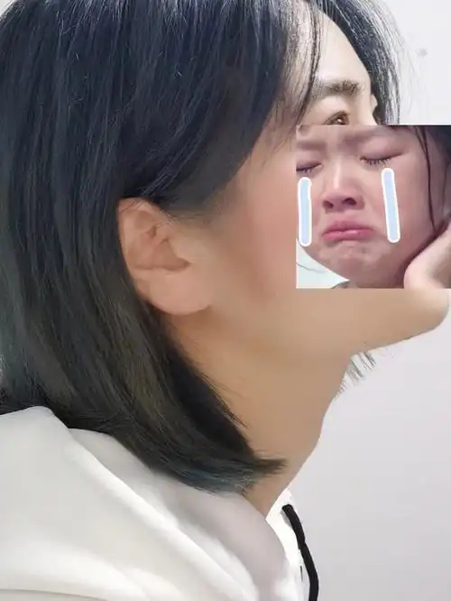 女生长喉结是不是不正常