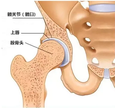 髋关节疼痛之髋臼唇撕裂影像学诊断 - 好大夫在线