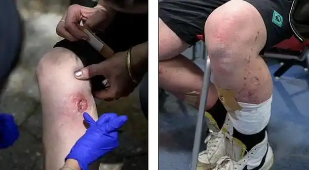 美国僵尸毒品加剧上升死亡人数白宫发布六点行动计划