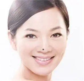 痣相,鼻梁上有痣代表着什么