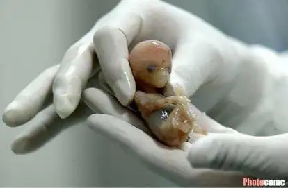 是一个人形婴儿了,这么可爱,再怎么有苦衷也不要这么轻易打掉他们好吗