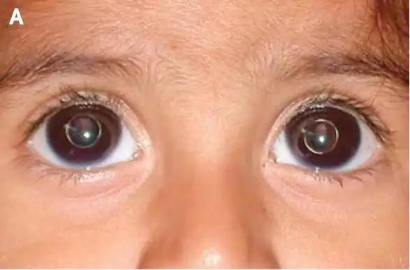 医学慕课-病例资料