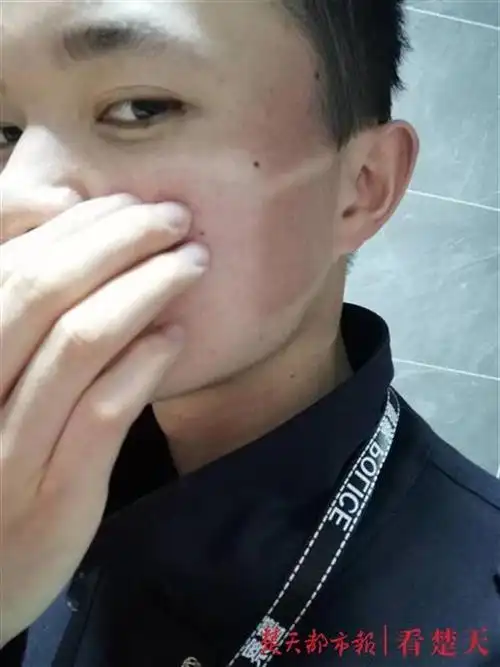 战"疫"汉警晒出"口罩脸"痕迹,网友赞誉"这是最帅的脸"