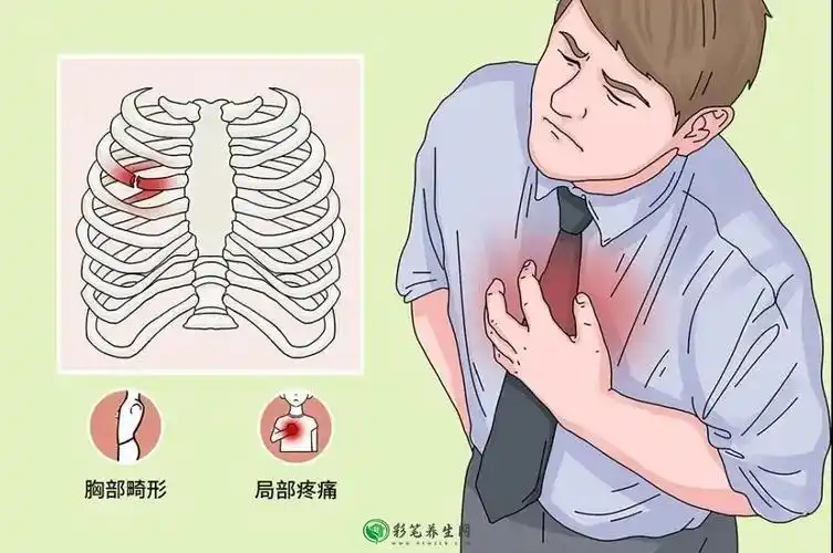 左侧肋骨下方疼痛是什么原因,可能左侧肋骨软骨炎 — 彩笔养生网