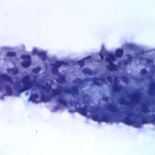 九张皮肤细胞学的典型镜检图片及分析