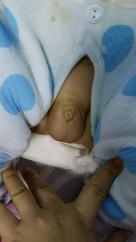 宝妈,男宝宝有鸡鸡小的吗?