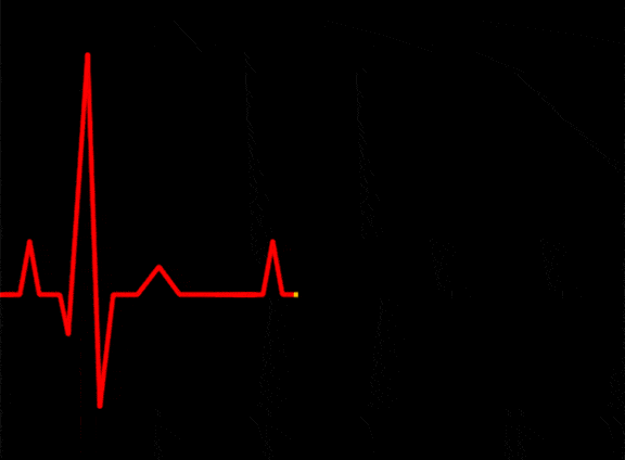 11年前全球首位无心人出现没有心跳与脉搏机器停止就死亡