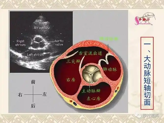 超声心动图常用切面的打法图解